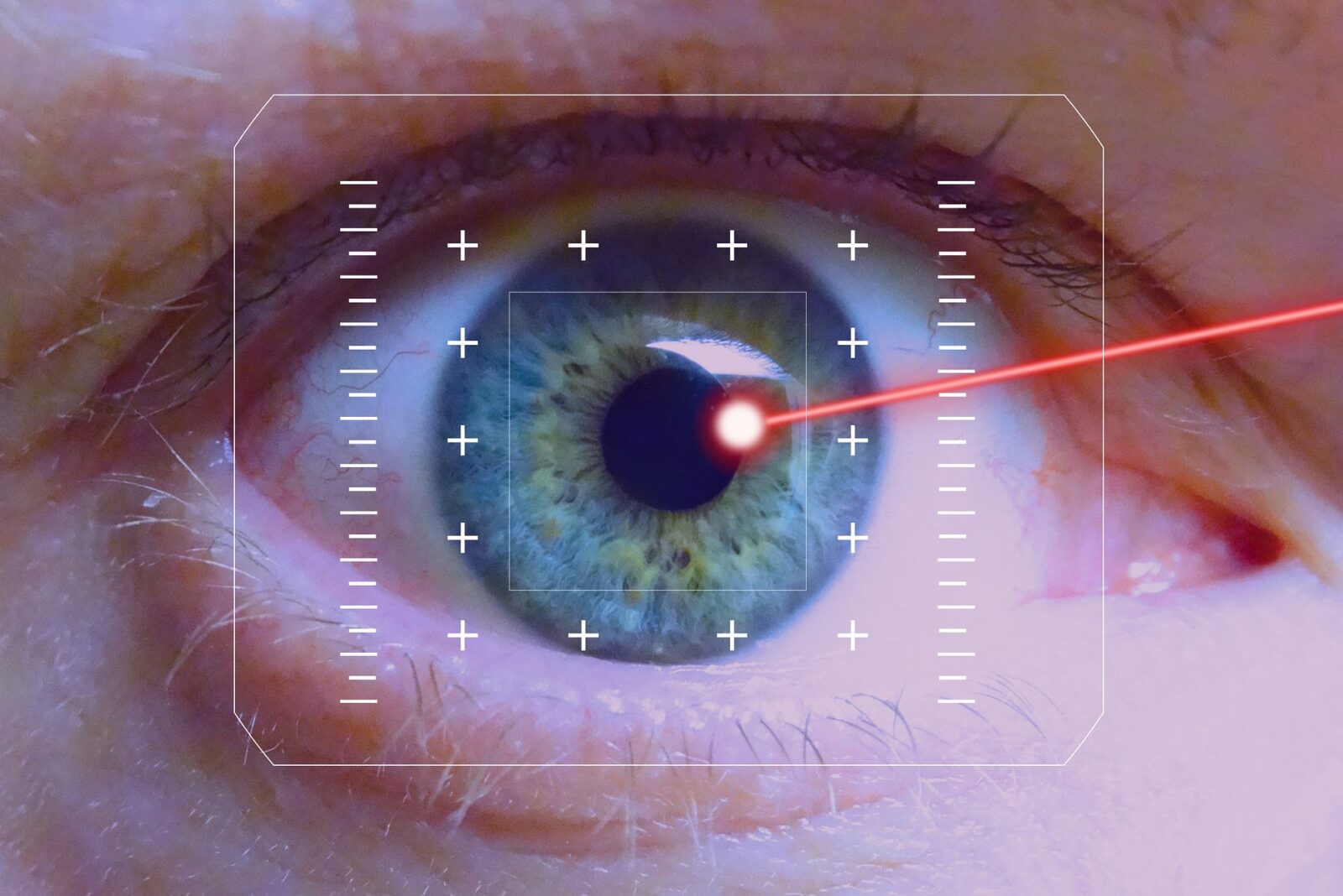 Modern LASIK Technology